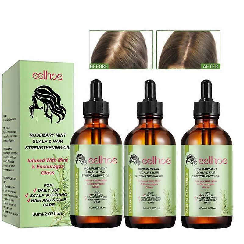 3Pcs ローズマリー ミント スカルプ&ヘア強化オイル ビオチン & エッセンシャルオイル、ナリッシングトリートメント