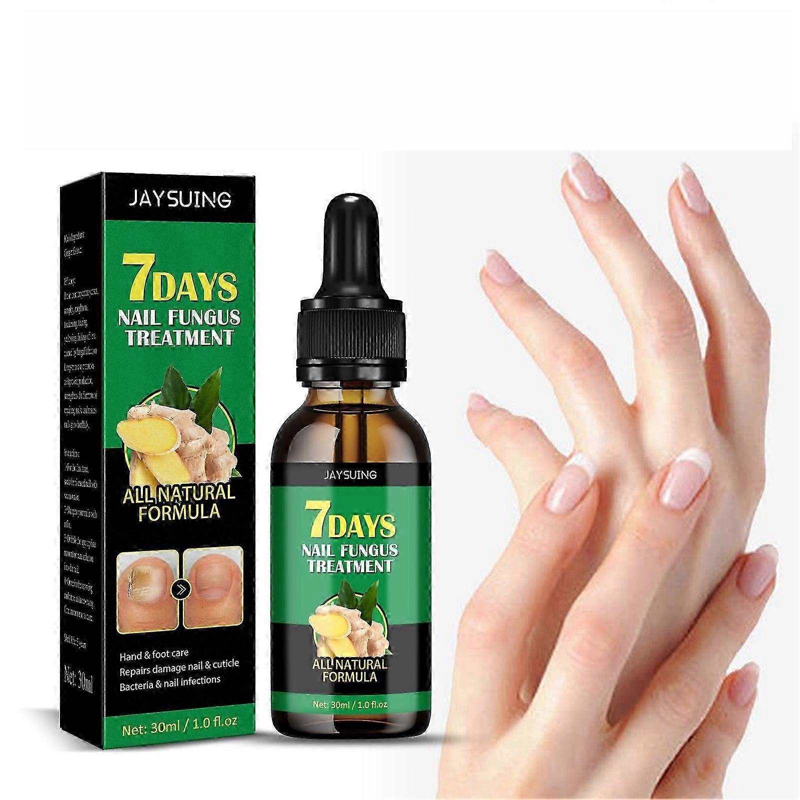 7 dagars nagelbehandling, ingefärsnagelbehandling, multifunktionell nagelreparation, nagelnäringsolja, stärkande oljeserum, ingefärsnageltillväxtolja