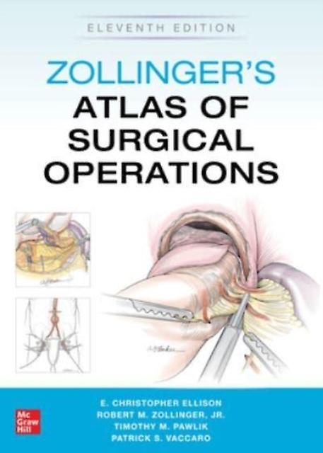 Zollingers Atlas Of Surgical Operations Eleventh Edition by Patrick Vaccaro Paperback Book