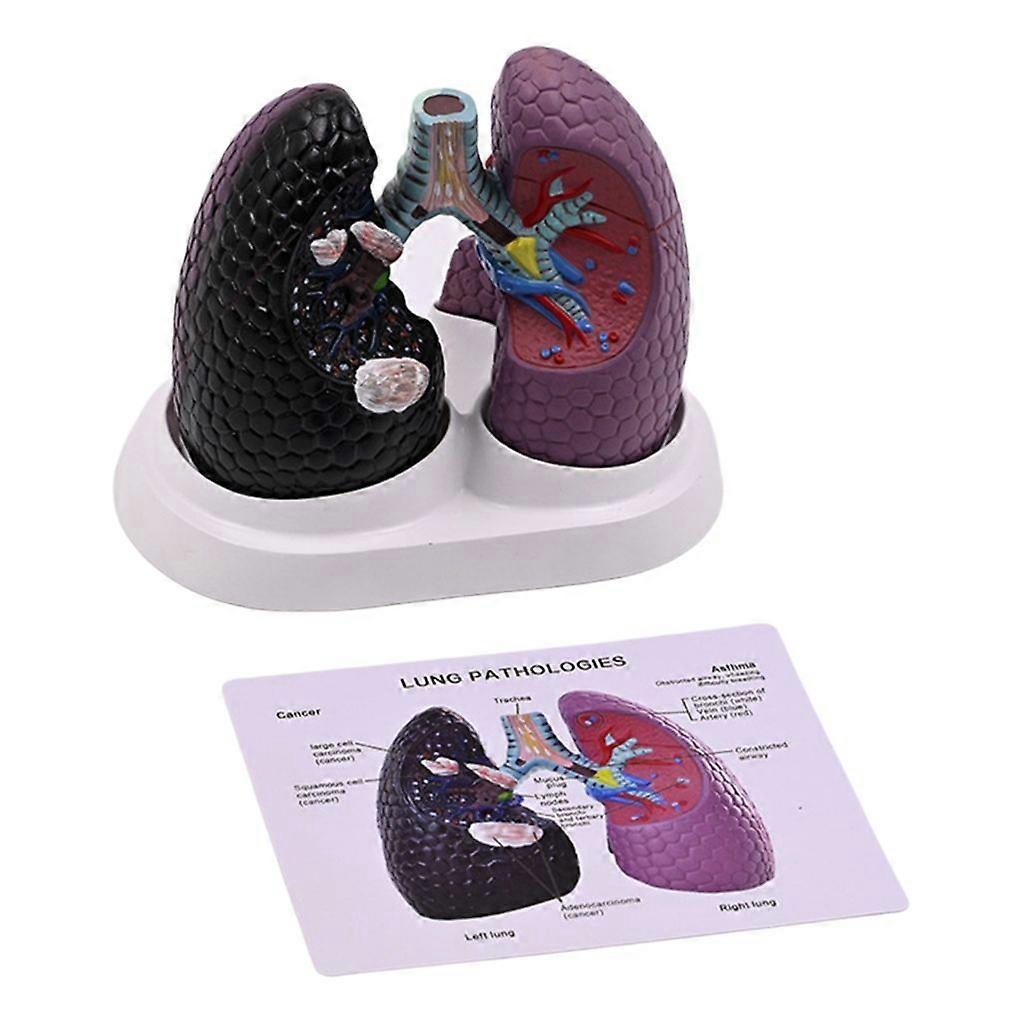 Pathological Lung Anatomy Model Human Anatomical Lung Model Teaching Tool