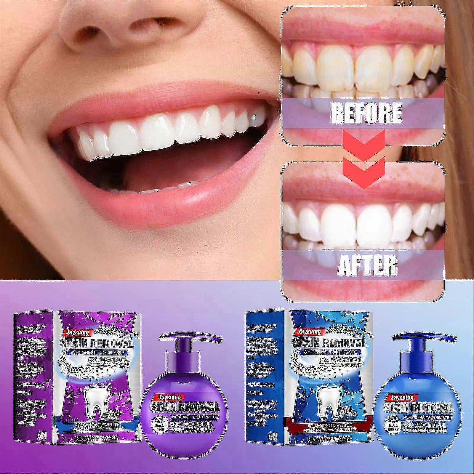 Jaysuing Oral Care Toothpaste Baking Soda Pressed Toothpaste Blueberry Passion Fruit Brightening Teeth