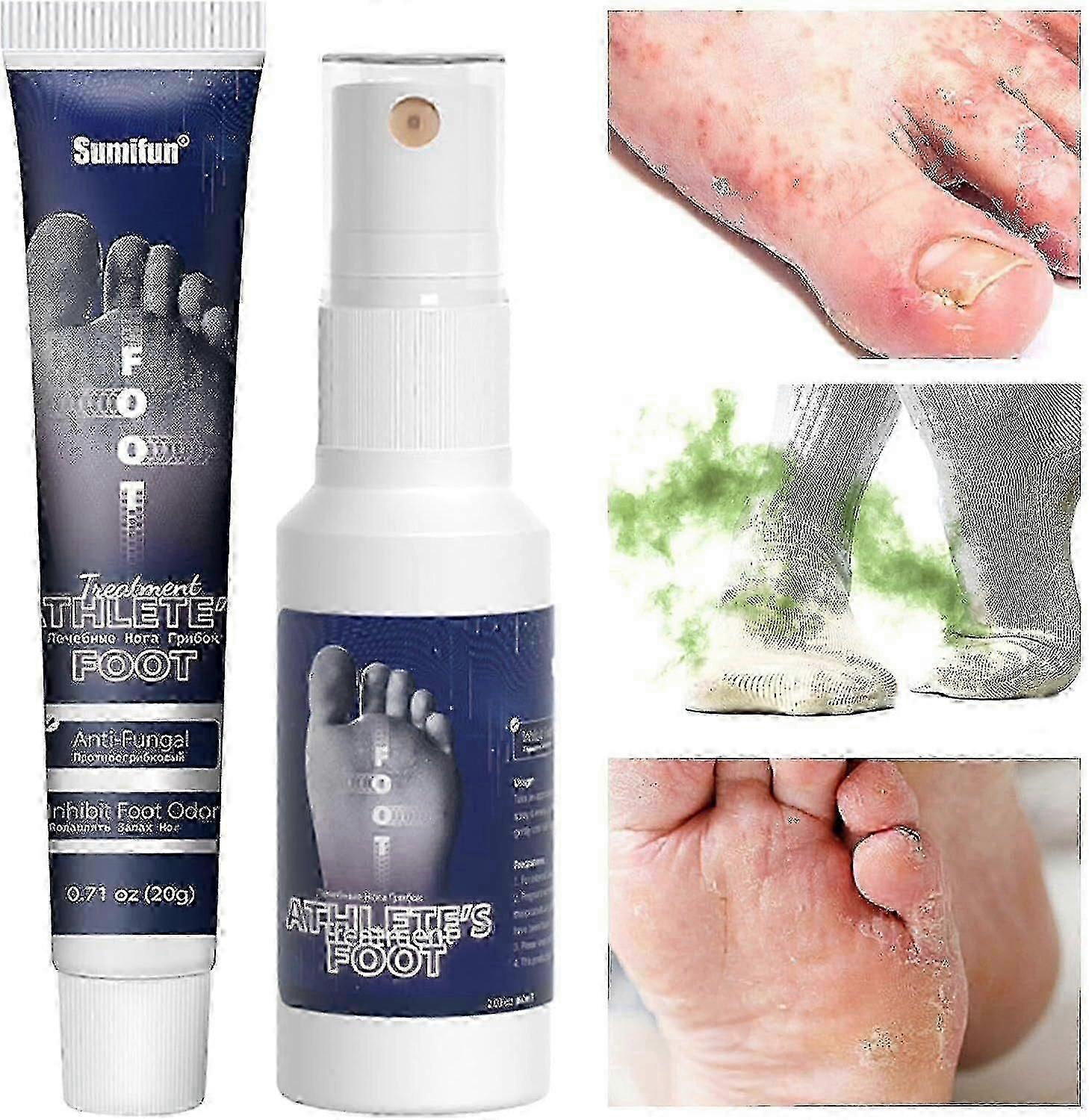 مجموعة كريم ورذاذ القدم للرياضيين ، كريم رائحة القدم ، منتجات العناية بالقدم Cs