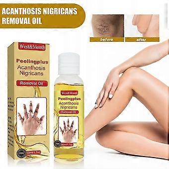 Olio peeling per la pelle scura, olio peeling giallo con ialuronato di sodio salicilico, olio peeling forte extra forza, soluzione peeling esfoliante per B