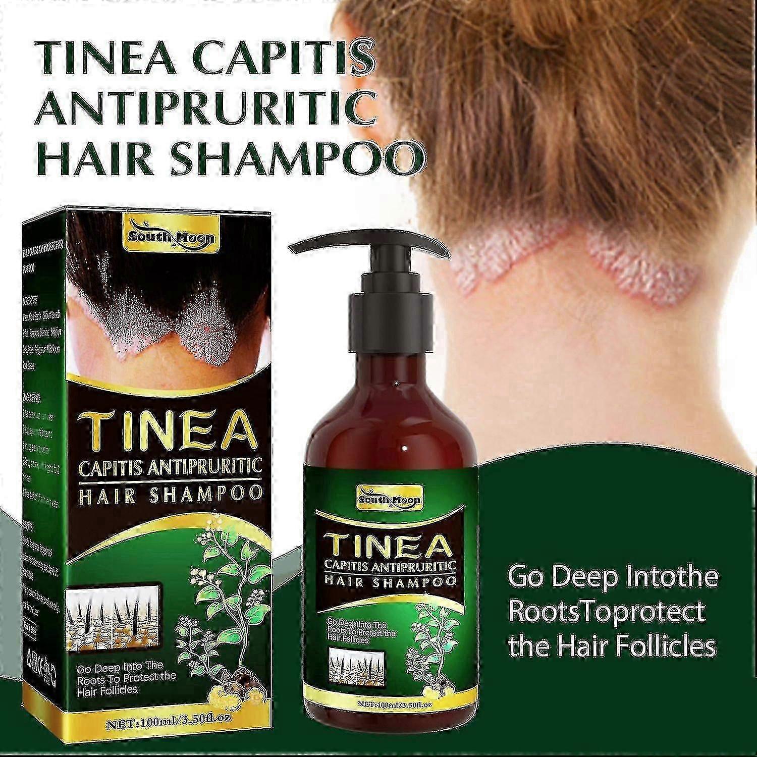 Tinea Capitis Antipruritic Shampoo