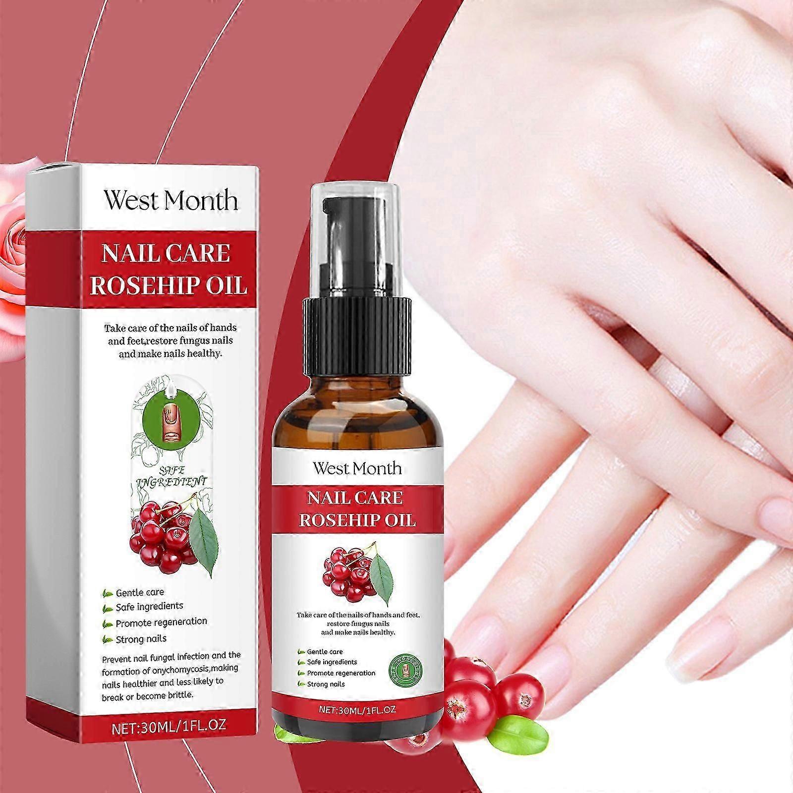 Nagelvård Nyponolja, Nagelsvamp Behandling, Tånagelsvamp Behandling, Extra Styrka Nagel Reparation Lösning För Nagel Förstärkning