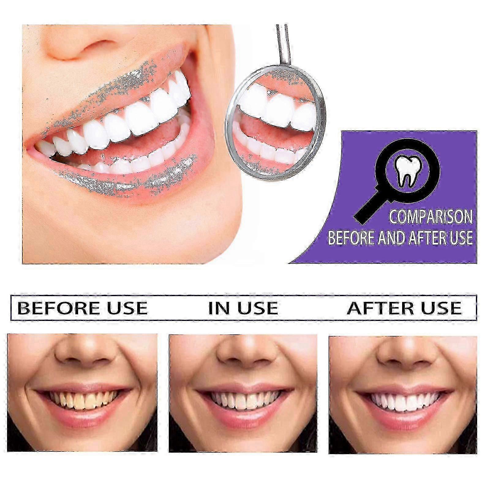 歯のホワイトニング歯磨き粉のホワイトニングと美化歯の汚れの除去臭いオーラルケアクリーニングホワイトニン