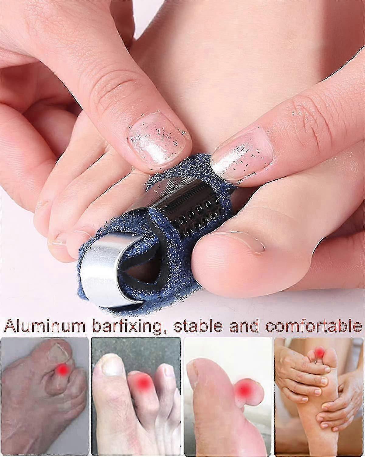 2pcs Toe Splint Broken Toe Brace, Toe Straightener For Hammer Toe, Curled Toe, Broken Toe Finger Joint Protective Band
