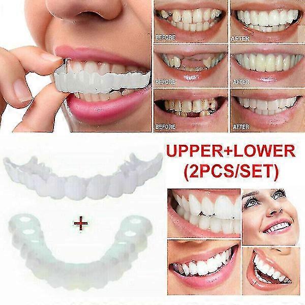 Snap On False Teeth Upper + Lower Dental Veneers Dentures Mouthguard Set A（Only Upper Teeth）