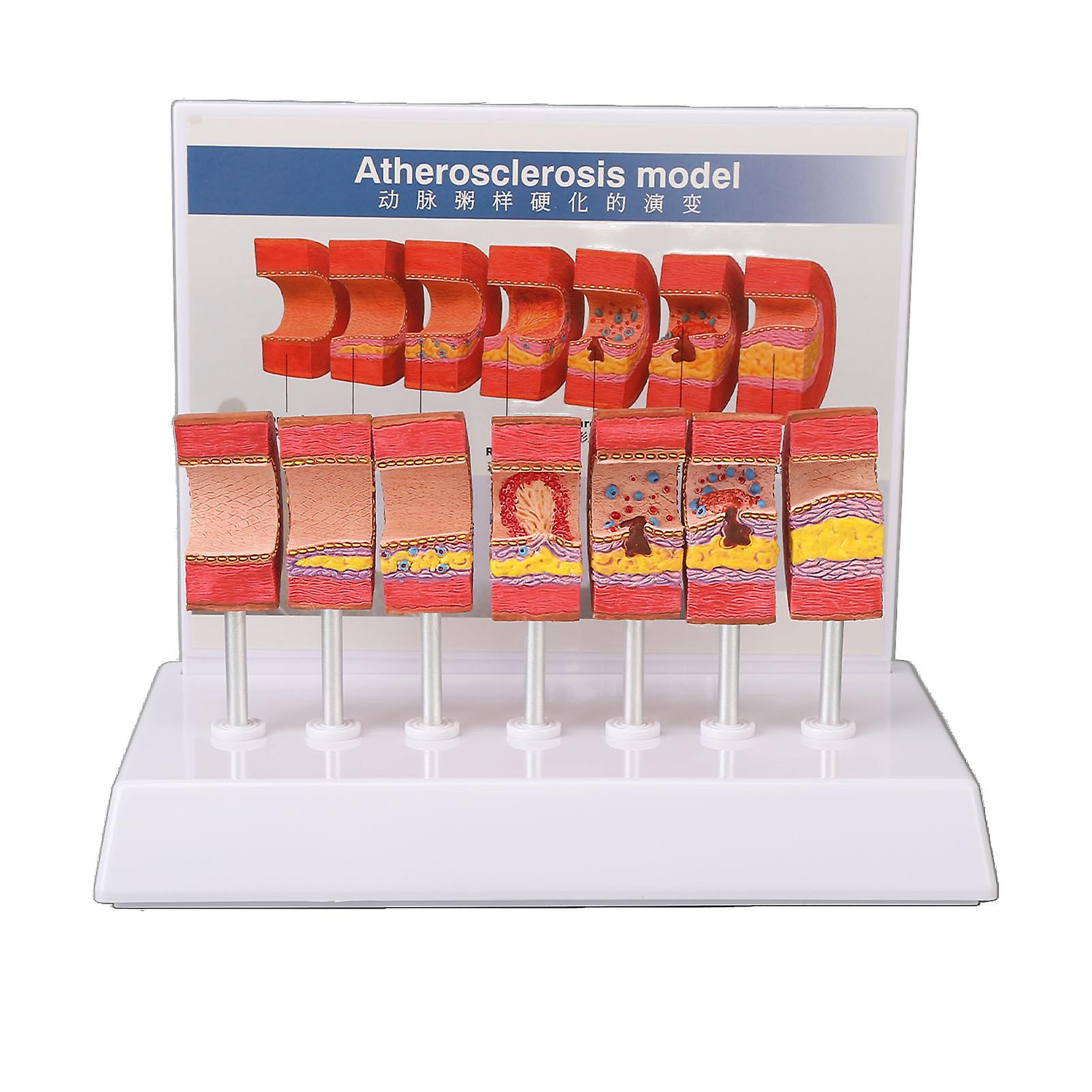 Respiratory System Model with Removable Heart Human Lung Anatomical Display for Students Study Teaching Tool