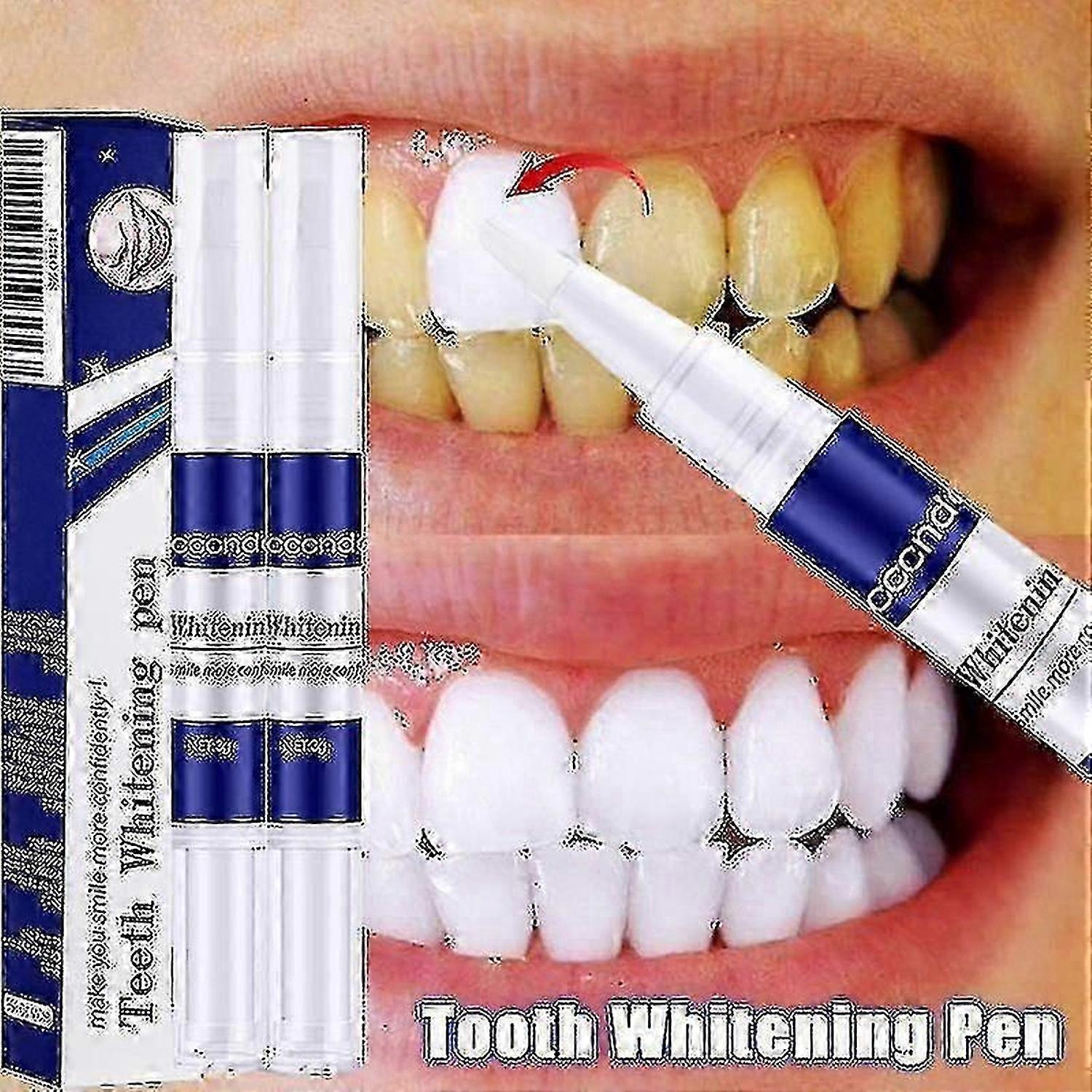 歯のホワイトニングペンは、歯垢の汚れを歯の漂白剤インスタント笑顔新鮮な息の口腔衛生クリーニングツール歯ケア製品を削除します