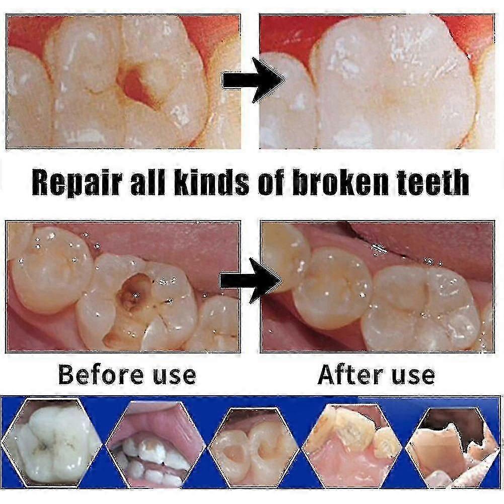 Repair Cement Teeth Gap Falseteeth Solid Glue Set Tooth Filling Kit Temporary Dental Fake Teeth Glue Tooth Gaps Repair Kit