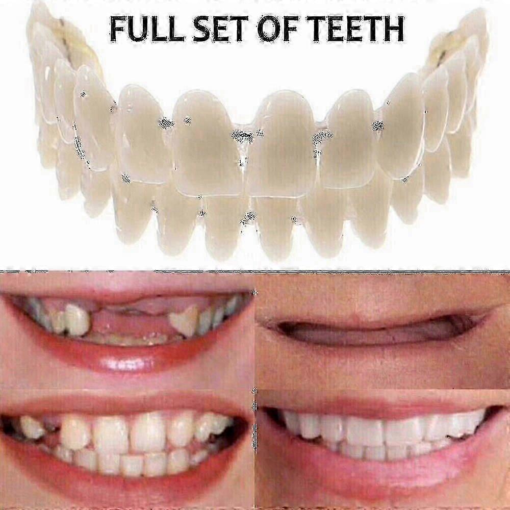 Snap-On False Teeth Covers for Upper & Lower Dentures, Removable Dental Veneers Set