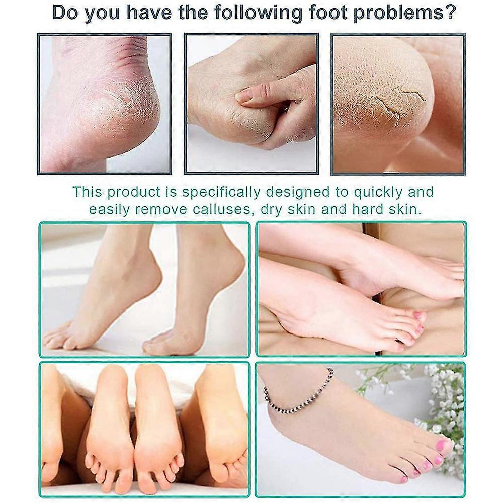 Pedicure Kit Professional, Exfoliation Calluses Foot File Set