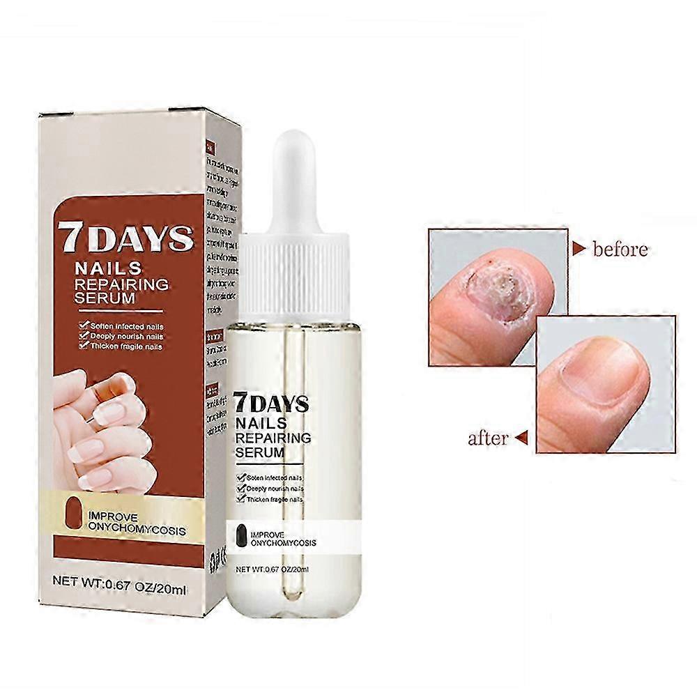 1-3PCS New 7 Days Nail Growth And Strengthening Serum Fast Dispatch 2024