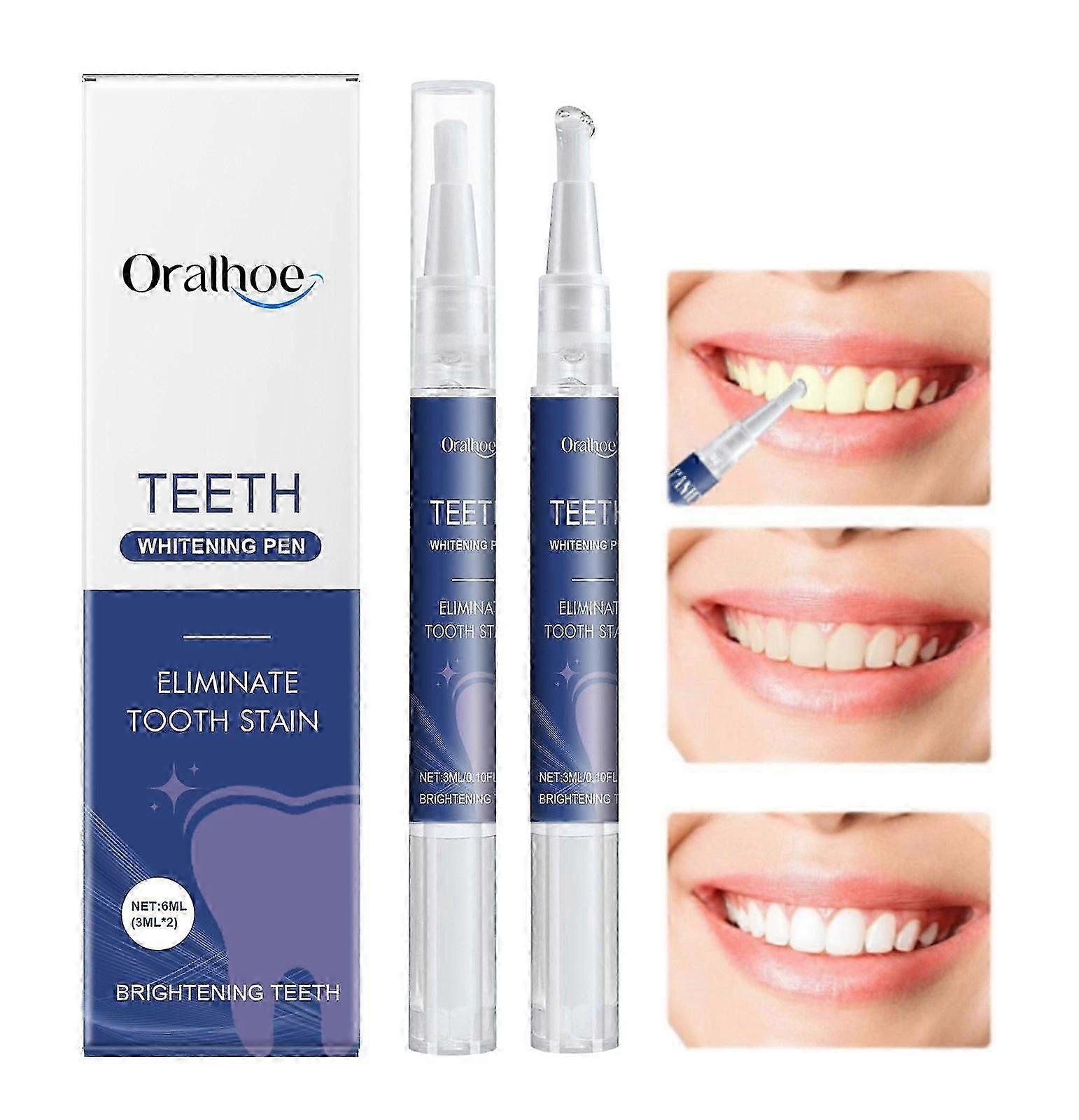 Pack of 2 Teeth Whitening Pen, Teeth Whitening Pen, Teeth Whitening Pen, Effective Stains, Quick Whitening Teeth, White Teeth at Home