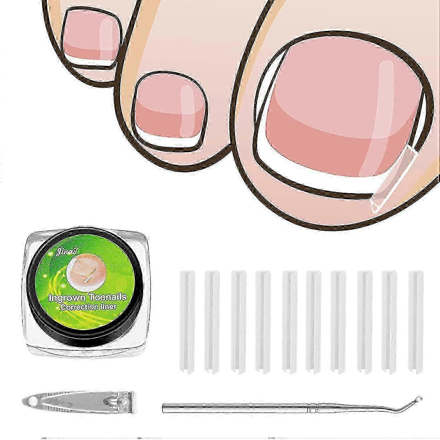 Ingrown Toenail Corrector Set - 50 Pcs Pain-Free Toenail Straightener Strips with Toenail Lifter - Easy Use Ingrown Toenail Tools Kit