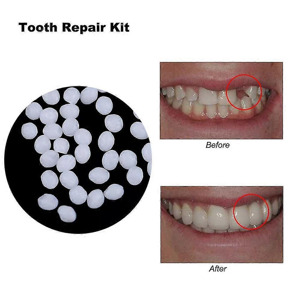 100g Resin False Teeth Solid Glue Temporary Tooth Repair Set Teeth And Gap False Teeth Solid Glue Denture Adhesive Dentist