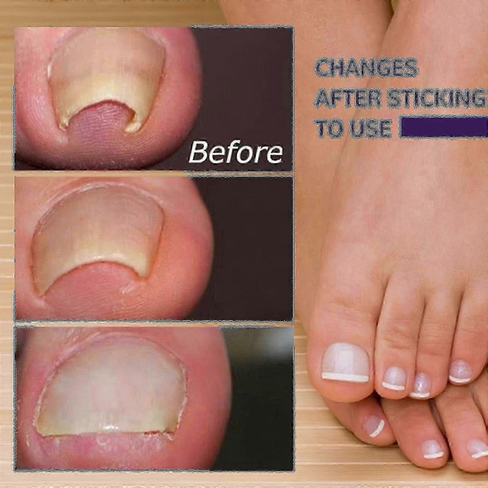 Toe Stickers Rep Inlay Sticker Groove Le B Pull Sticke