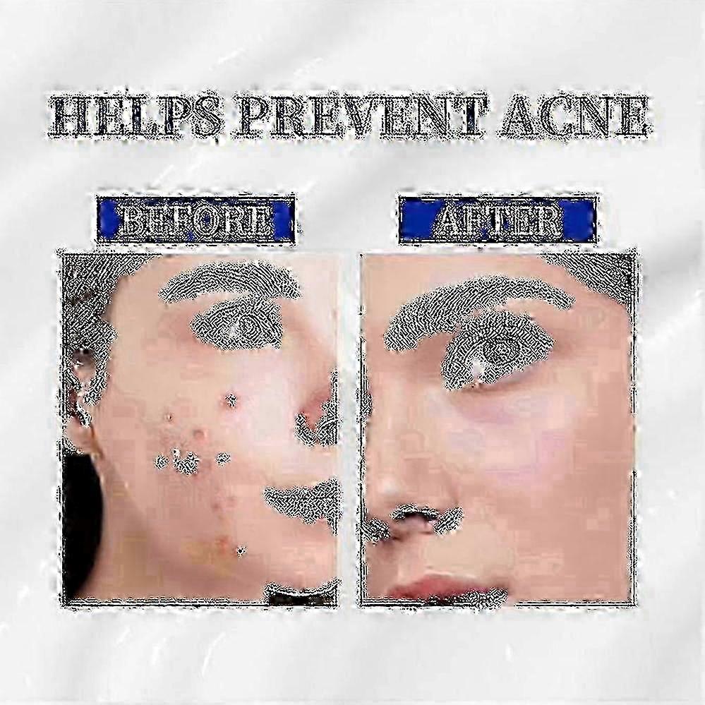 Advanced A-313 Retinol Anti-Aging Cream for Face in 2025