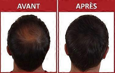 Hair Rebirth Fibers Setting