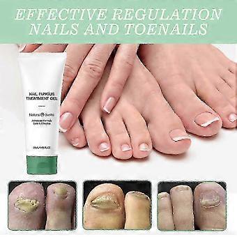 Nutraboost Nail Repair Gel, 20ml Serum til behandling og styrkelse af neglesvamp