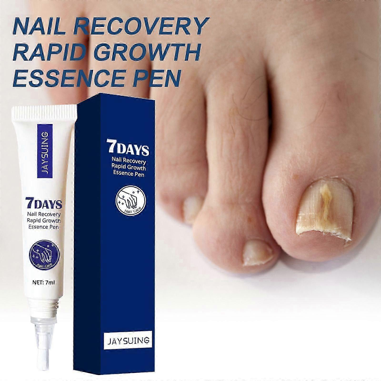 7-Day Nail Repair serum