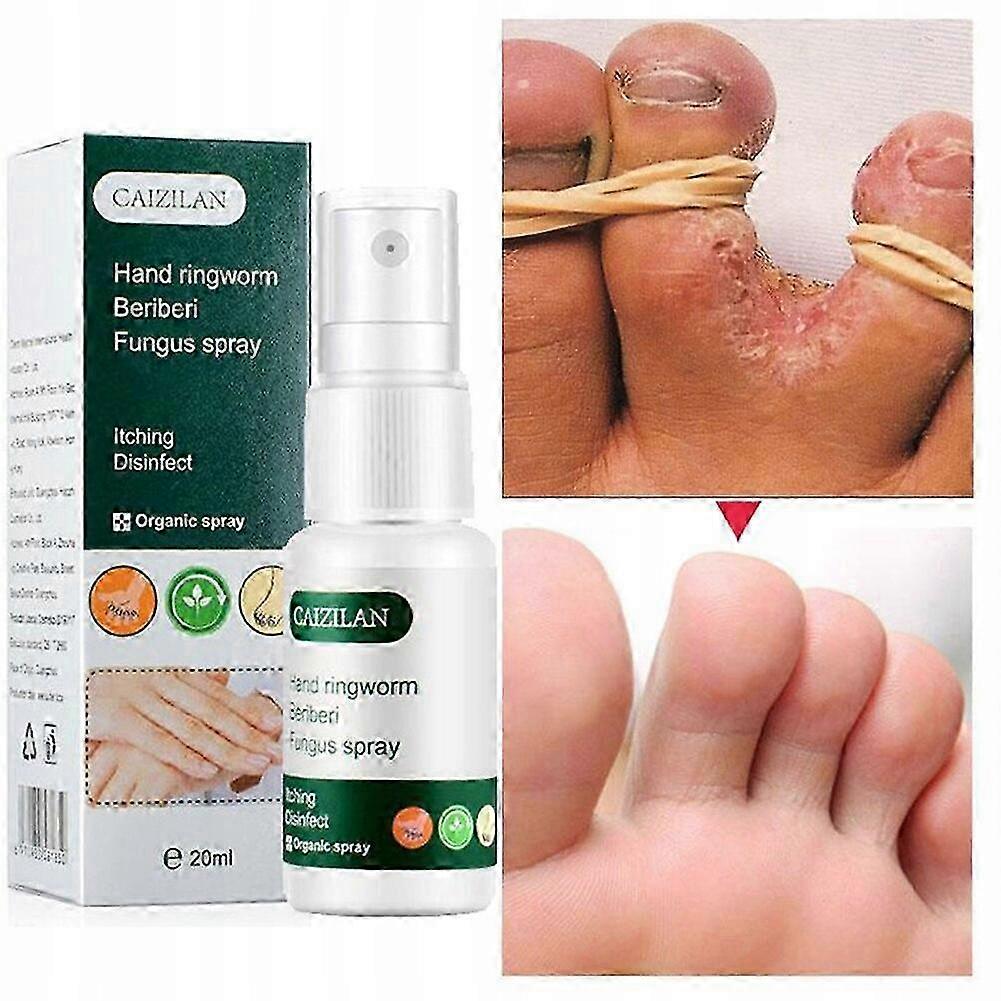 Antischimmel voetspray Schimmelcrème_ecs