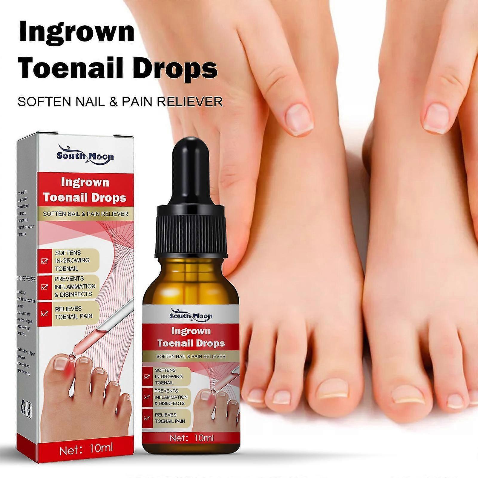 10/30ml Nail Helper Ingrown Toenail Treatment Oil, South Moon Ingrown Toenail Drops, Ingrown Toenail Correction Treatment Oil For Pain Reliever And So