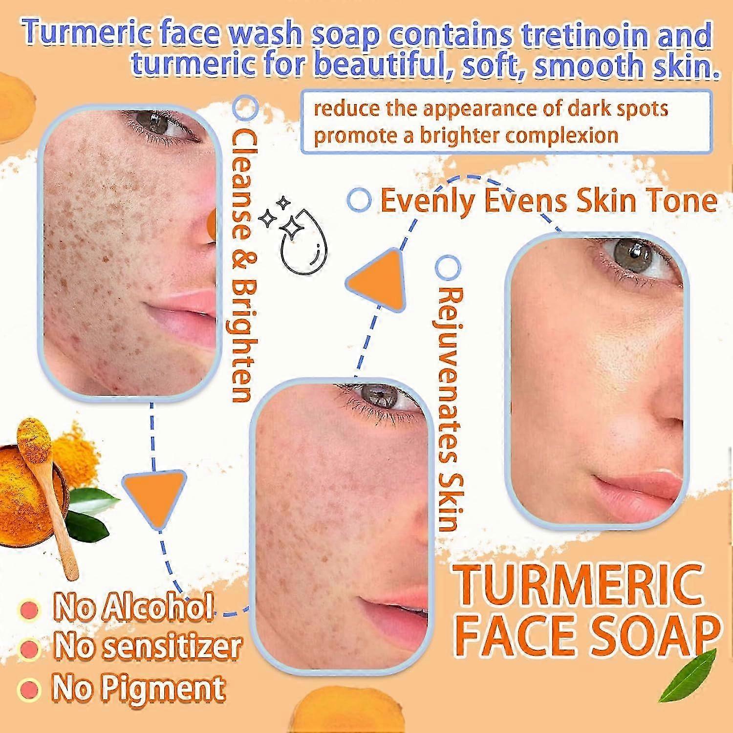 Turmeric Dark Spot Remover Soap Bars with Vitamin C, Retinol, Collagen, Natural Turmeric Handmade Soap with a Foam Net For All Skin Types For Men and