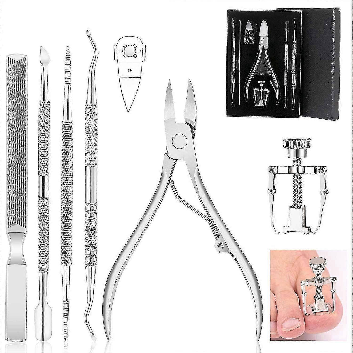 Ensemble d’ongles incarnés, 7pcs ensemble de manucure et de pédicure en acier inoxydable, kit de coupe-ongles incarnés professionnel tw