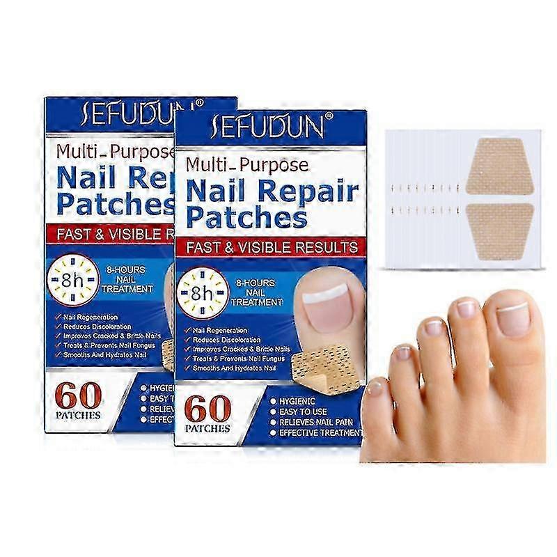 WJTG SEFUDUN Nail Repair Patch Embedded Toenail Corrector Toenail Patch 60 Pieces 1J 2025