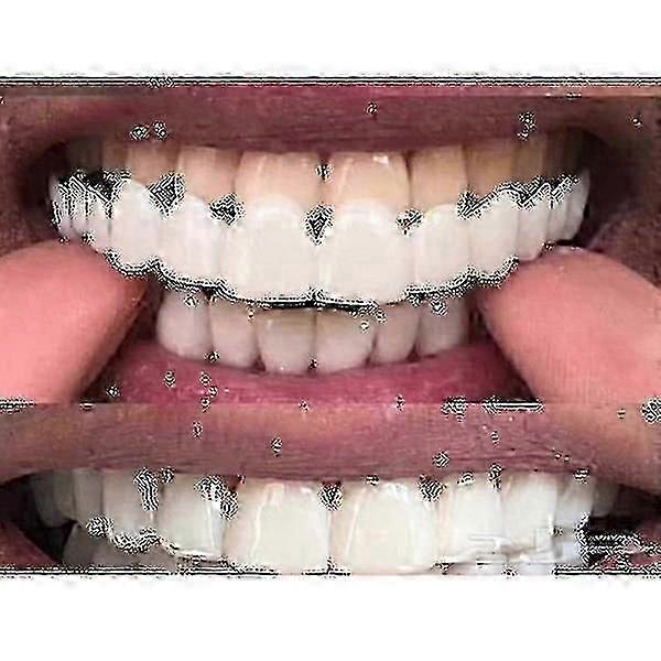 Comfort Fit Flex Whitening Denture Braces Suitable for Upper/Lower Use