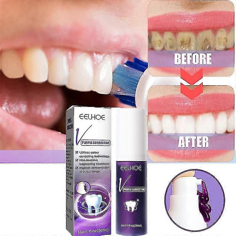 Teeth Cleaning Whitening Toothpaste Dental Tools Bleaching Remove Plaque St