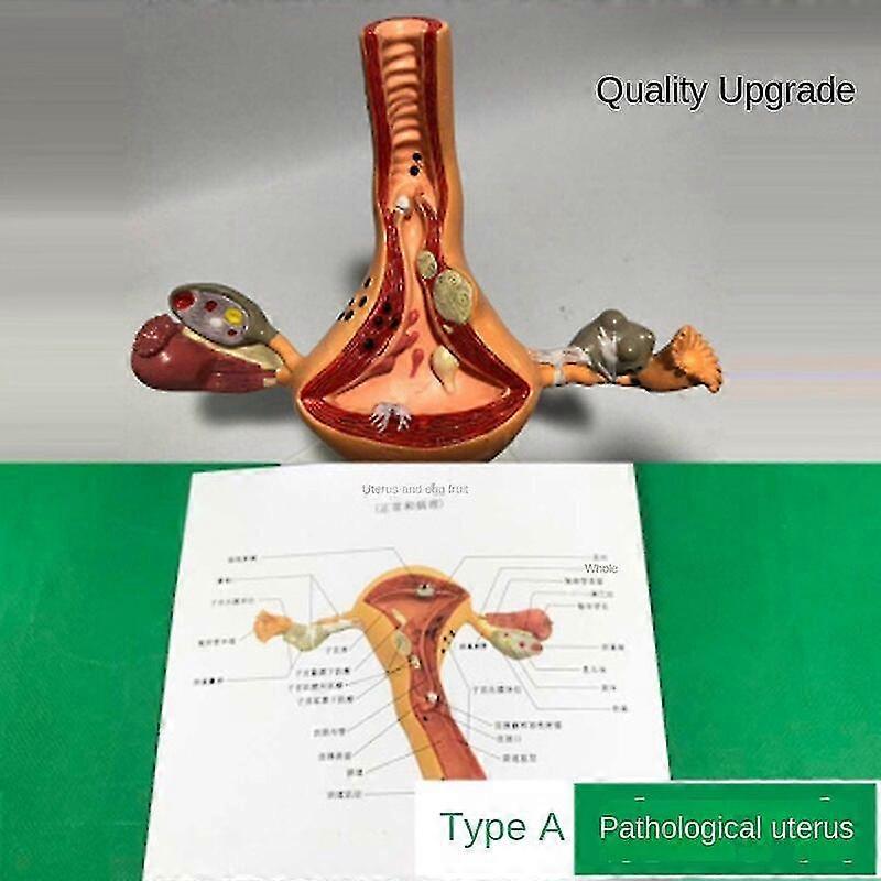Eierstock Und Gebärmutter Dissektion Pathologie Der Weiblichen Gebärmutter Lehre Der Anatomie Der
