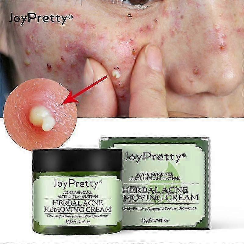 Picture of New Tea Tree Acne Removing Cream, Oil Control And Cleaning Plant Cream ...