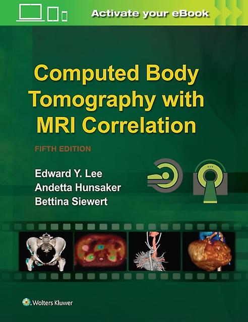 Computed Body Tomography With Mri Correlation by Siewert & Bettina & MD & MPH Book