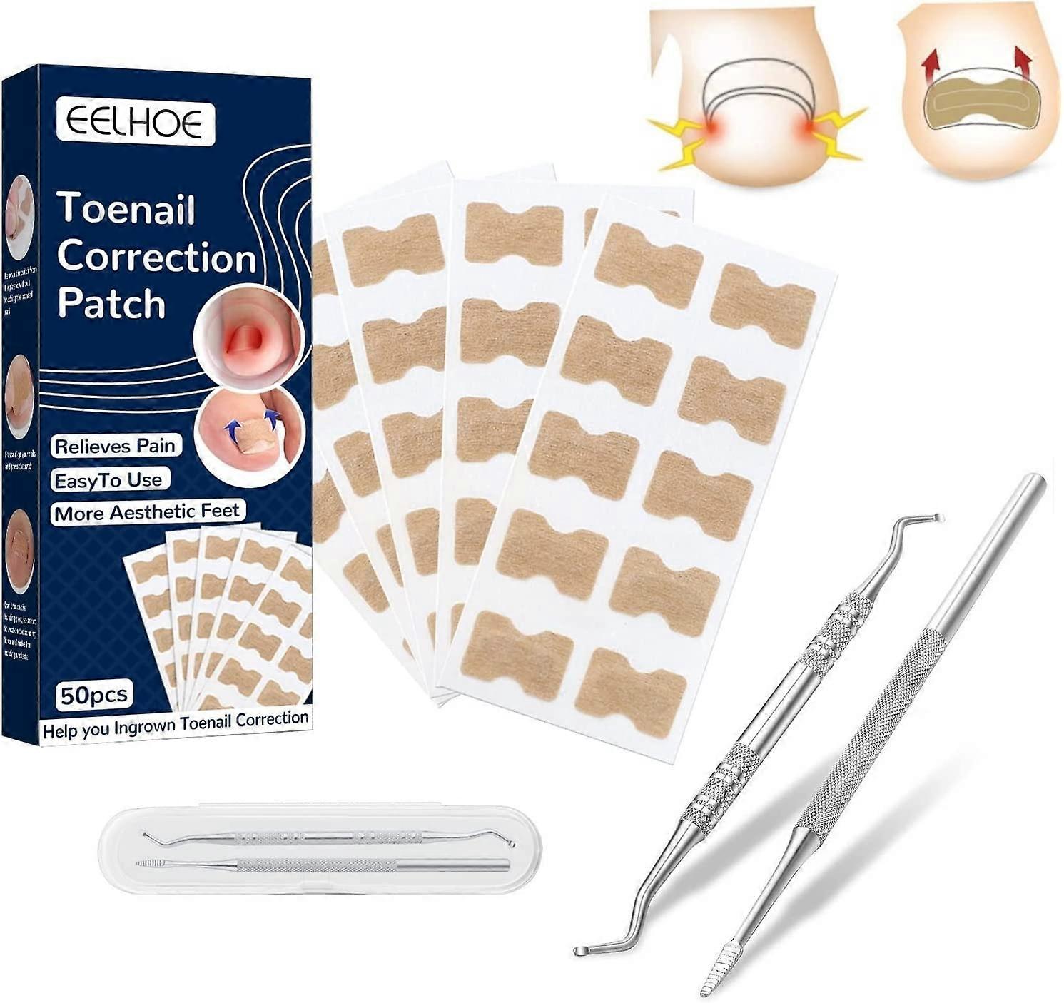 50Pcs Health Toenail Corrector Patch, Professional Ingrown Toe Nail Correction Sticker Treatment Tool Kit with 2 Pcs Ingrown Toenail File and Lifter