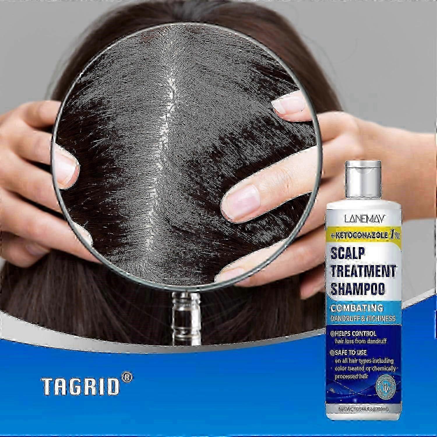 شامبو كيتوكونازول لعلاج فروة الرأس - شامبو مضاد للقشرة - تخفيف حكة فروة الرأس ، التهاب الجلد الدهني ، علاج التهاب الجريبات ، شامبو الصدفية -