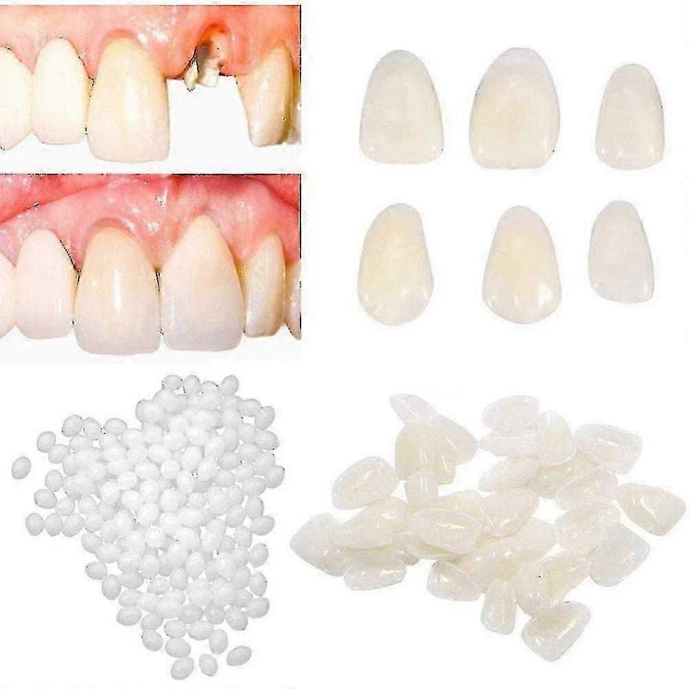 Temporary Tooth Repair Kit For Filling The Missing Broken And Gaps-moldable Fake