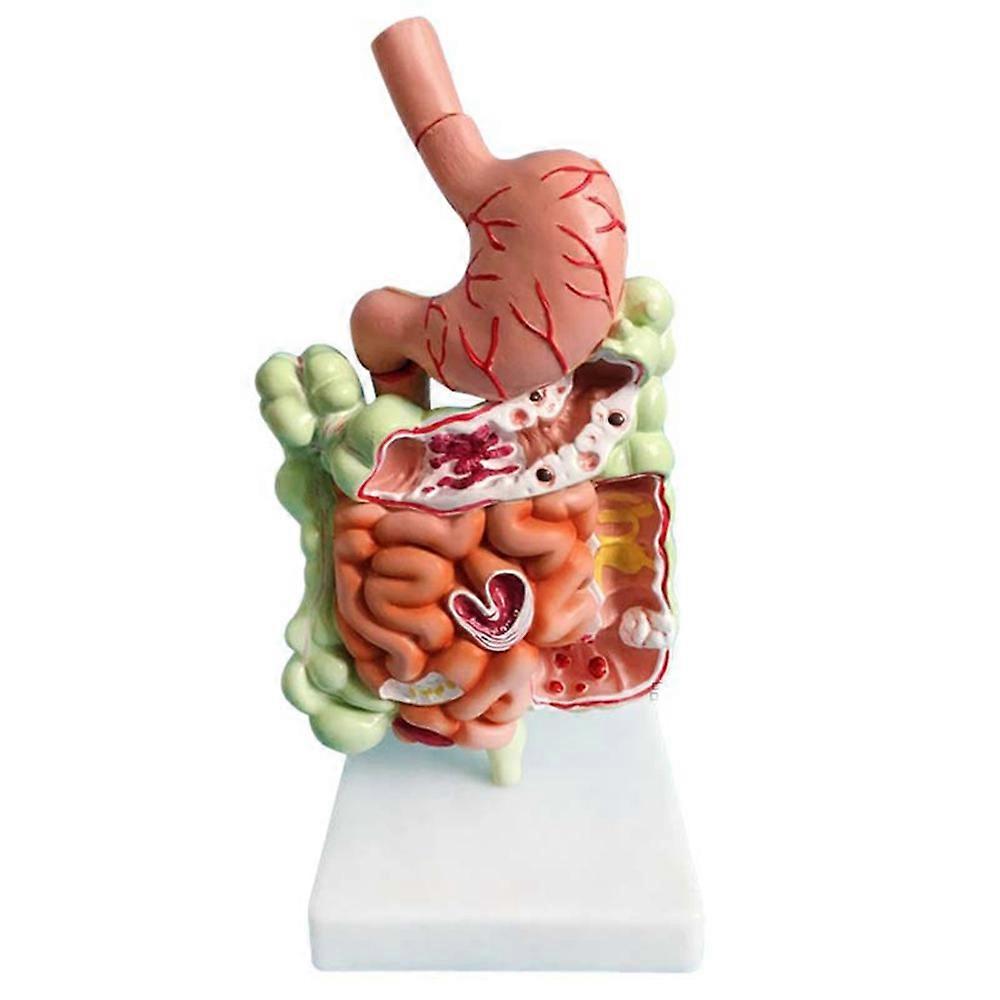 Human Digestive System Model Stomach Anatomy Large Intestine Cecum Rectum Duodenum Human Internal O