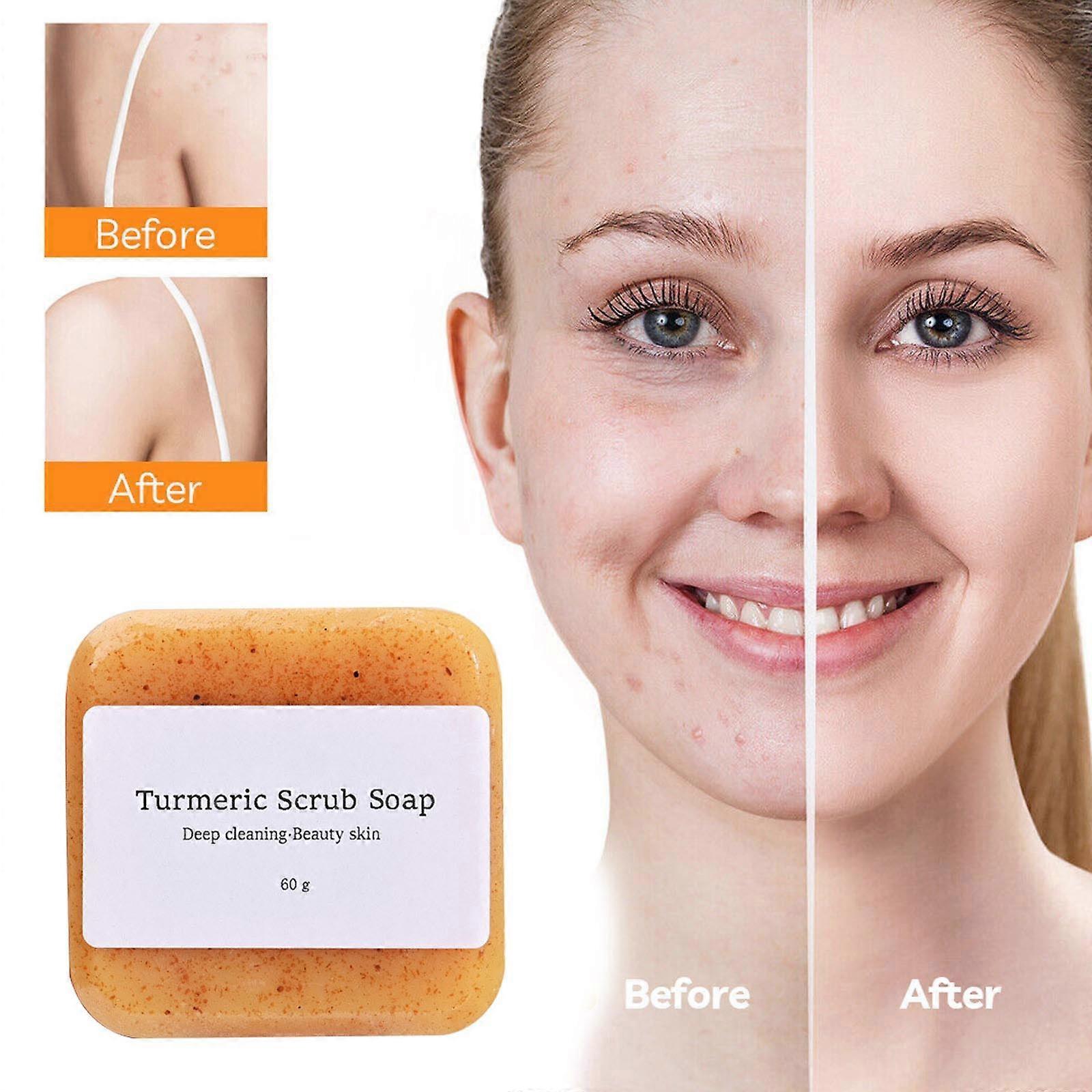 Soap Lemon Turmeric Soap Tablets Cleansing Turmeric Soap Facial And Body Shower Soap Firming Pores And Removing Pigments Cosmetic Sets FLY2254