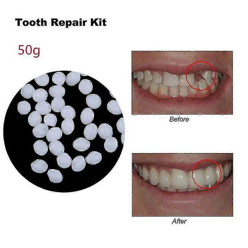 30-50g Diş Tamir Tutkalı Reçine Reçine Protez Yapıştırıcı Geçici Sahte Diş Dolgusu-ykc