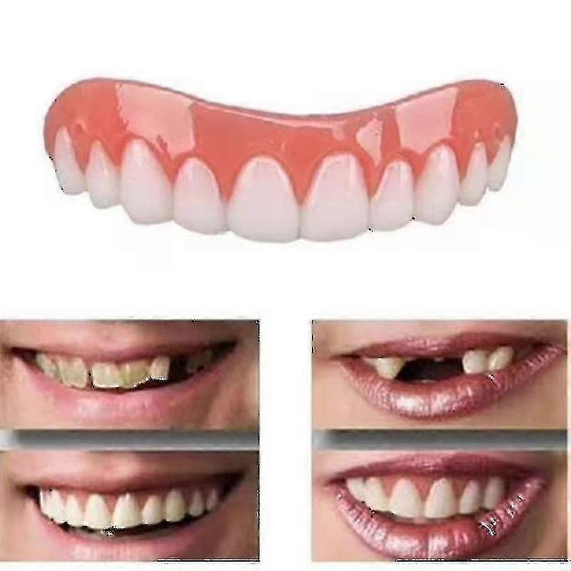 2 Sets Of Dentures, Upper And Lower Jaw Dentures, Natural And Comfortable, Protect The Teeth, And Regain A Confident Smile