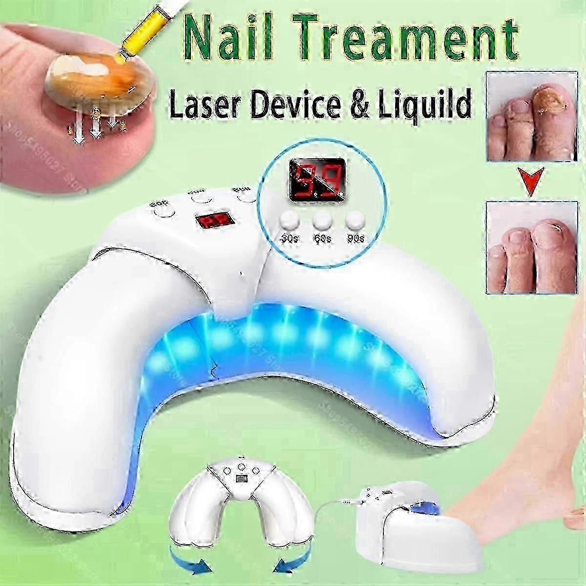 2025 Dispositif de traitement des champignons des ongles au laser pour l’élimination de l’onychomycose et le soin des ongles d’orteils
