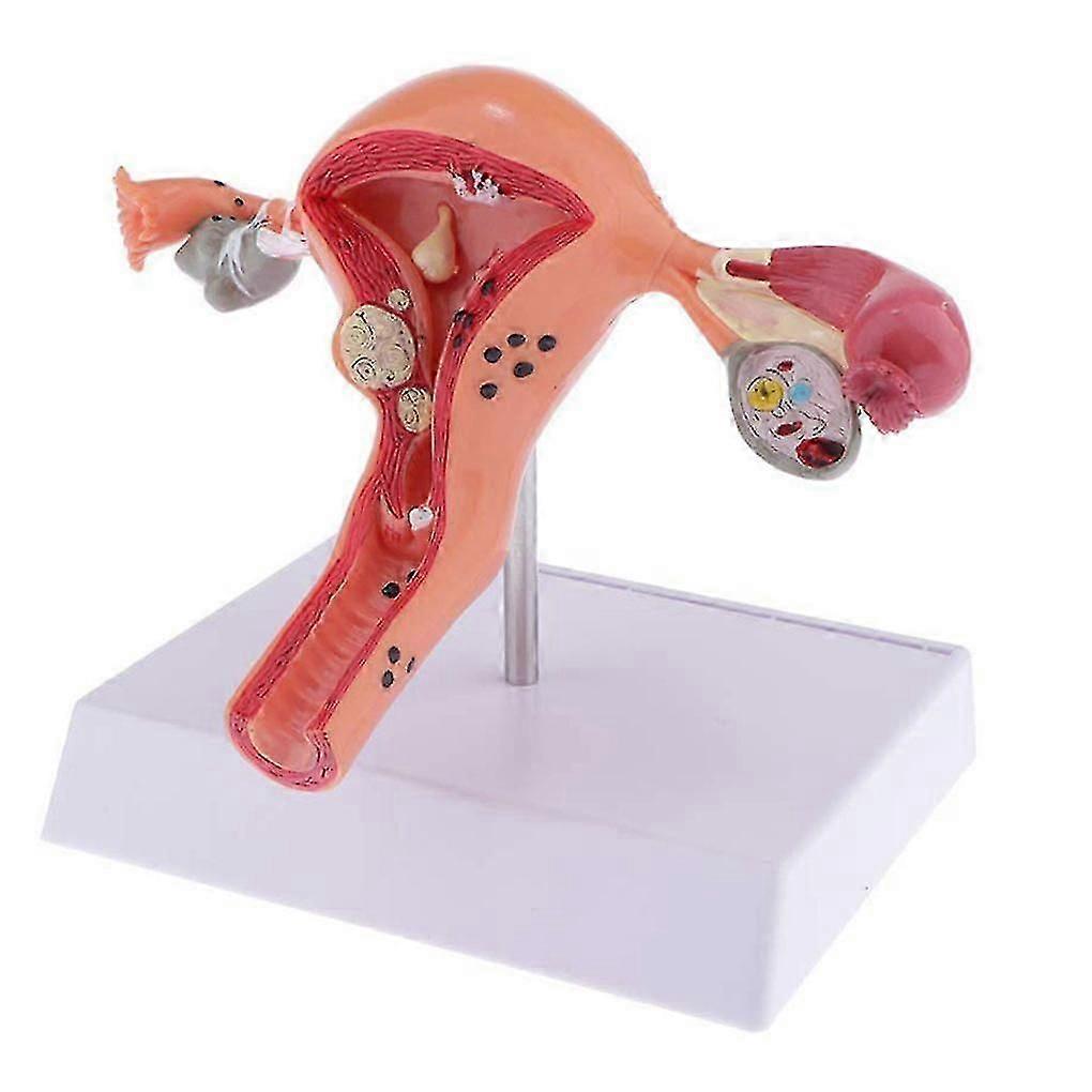 Female Uterus Structure Biological Models Educational Experiment