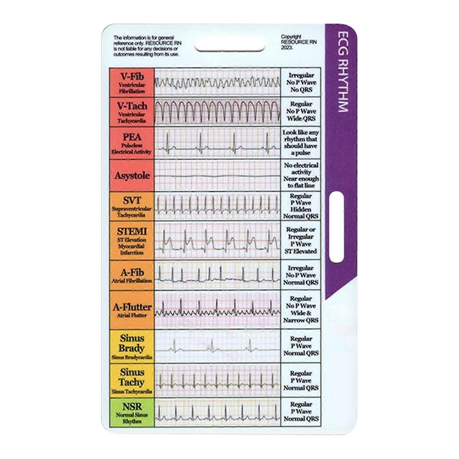 Electrocardiogram/EKG Rhythms Pocket Card Double Sided EKG Rhythms Interpretation Reference Card for Nurses Students