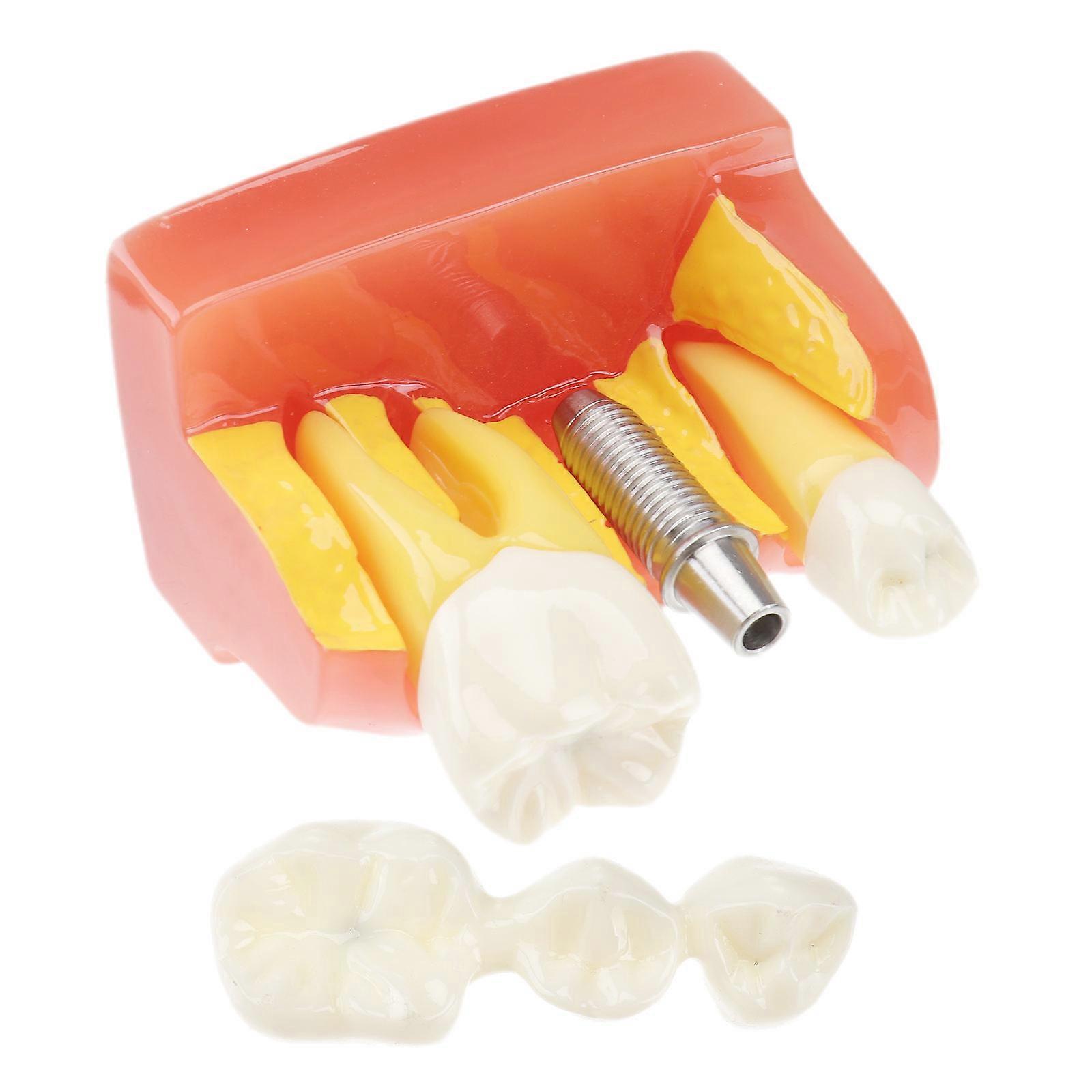 Oral Education Tooth Model with Removable Teeth for Study 1Pcs