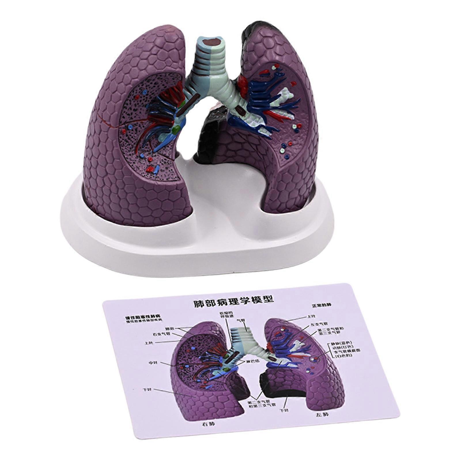 Human Anatomical Lung Model Realistic Pathological Lung Anatomy Model for Teaching Demonstration and Educational Use