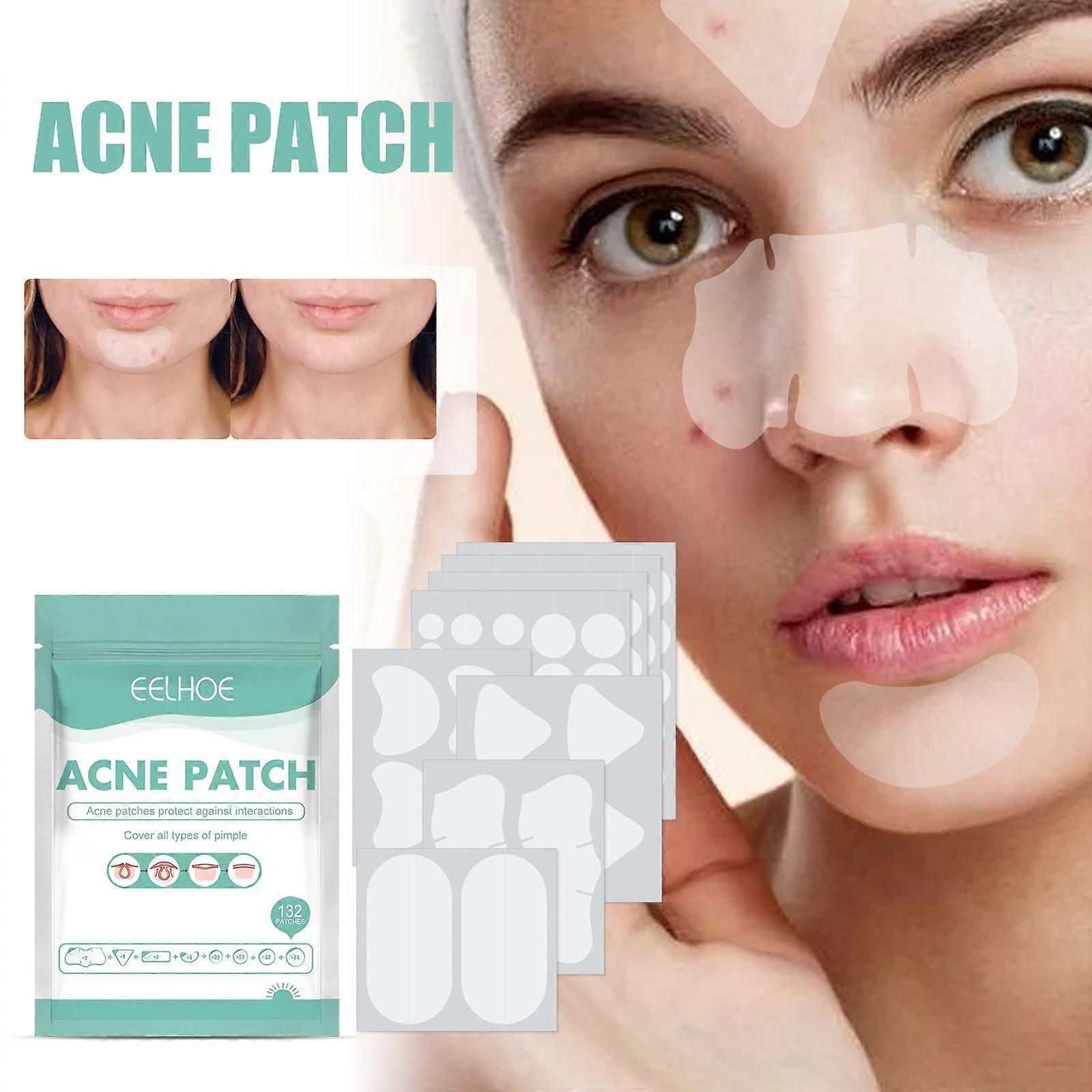 Acne Pimple Patches, 132 Patches For Large Zit Breakouts, Acne Patches For Face, Chin Or Body, Hydrocolloid Bandages Acne With Tea