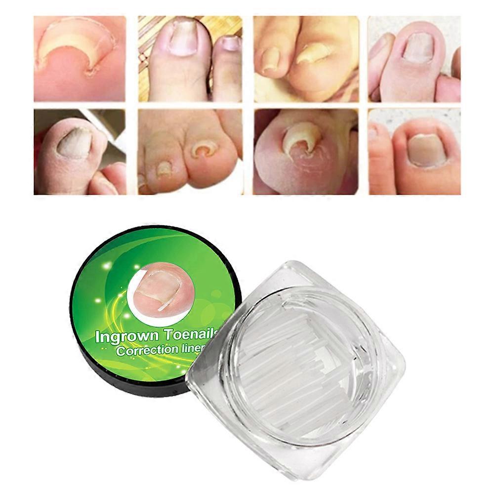10Pcs C Shape Ingrown Toe Nail Correction Pad Paronychia Corrector Pad Sticker